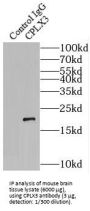 Complexin-3 (CPLX3) Antibody