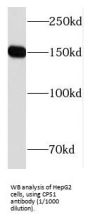 Carbamoyl-Phosphate Synthase 1 (CPS1) Antibody