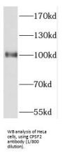 Cleavage And Polyadenylation Specificity Factor Subunit 2 (CPSF2) Antibody