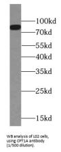 Carnitine Palmitoyltransferase 1A, Liver (CPT1A) Antibody