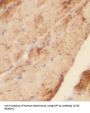 Carnitine Palmitoyltransferase 1A, Liver (CPT1A) Antibody