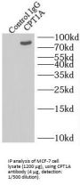 Carnitine Palmitoyltransferase 1A, Liver (CPT1A) Antibody