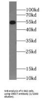 Calcium-Responsive Transactivator (SS18L1) Antibody