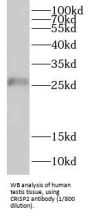 Cysteine-Rich Secretory Protein 2 (CRISP2) Antibody