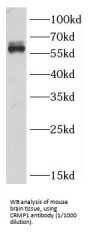 Collapsin Response Mediator Protein 1 (CRMP1) Antibody