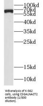 Chondroitin Sulfate N-Acetylgalactosaminyltransferase 2 (CSGALNACT2) Antibody