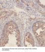 Cutaneous T-Cell Lymphoma-Associated Antigen 1 (CTAGE1) Antibody