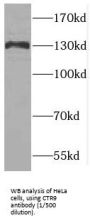 RNA Polymerase-Associated Protein CTR9 Homolog (CTR9) Antibody