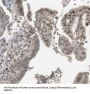 RNA Polymerase-Associated Protein CTR9 Homolog (CTR9) Antibody