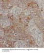 Cytochrome B5 Reductase 1 (CYB5R1) Antibody