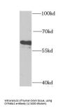 Cholesterol 24-Hydroxylase (CYP46A1) Antibody