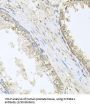 Cholesterol 24-Hydroxylase (CYP46A1) Antibody
