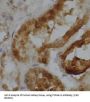 Cytochrome P450 4A11 (CYP4A11) Antibody