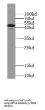 Cytokeratin 13-Specific Antibody