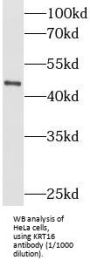 Cytokeratin 16 (CK16) Antibody