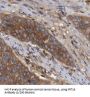 Cytokeratin 16 (CK16) Antibody