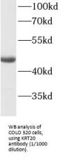 Cytokeratin 20 (CK20) Antibody