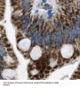 Cytokeratin 20 (CK20) Antibody