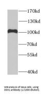 ATP-Dependent RNA Helicase DDX1 (DDX1) Antibody