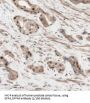 DNA Fragmentation Factor 45 KDa Subunit (DFFA) Antibody