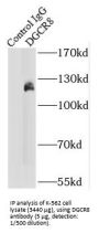 DiGeorge Syndrome Critical Region Gene 8 (DGCR8) Antibody