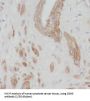 Diacylglycerol Kinase Epsilon (DGKE) Antibody