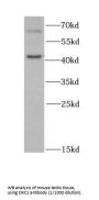 H/ACA Ribonucleoprotein Complex Subunit DKC1 (DKC1) Antibody