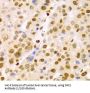 H/ACA Ribonucleoprotein Complex Subunit DKC1 (DKC1) Antibody