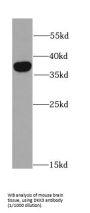 Dickkopf-Related Protein 3 (DKK3) Antibody