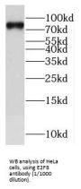 E2F Transcription Factor 8 (E2F8) Antibody