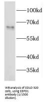 Endonuclease/Exonuclease/Phosphatase Family Domain Containing 1 (EEPD1) Antibody