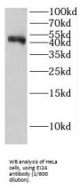 Etoposide Induced 2.4 (EI24) Antibody