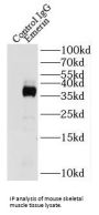 Emerin (EMD) Antibody