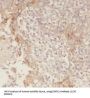 Ecto-NOX Disulfide-Thiol Exchanger 1 (ENOX1) Antibody