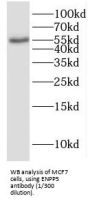 Ectonucleotide Pyrophosphatase/Phosphodiesterase 5 (ENPP5) Antibody