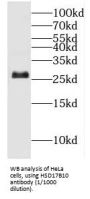 Endoplasmic Reticulum-Associated Amyloid Beta-Peptide-Binding Protein (ERAB) Antibody