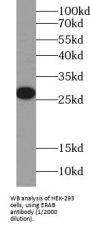 Endoplasmic Reticulum-Associated Amyloid Beta-Peptide-Binding Protein (ERAB) Antibody