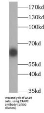 Endoplasmic Reticulum Aminopeptidase 2 (ERAP2) Antibody
