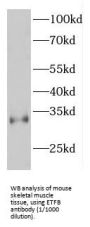 Electron Transfer Flavoprotein Beta Polypeptide (ETFB) Antibody