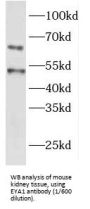 Eyes Absent Homolog 1 (EYA1) Antibody