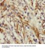 Family With Sequence Similarity 156, Member A (FAM156A) Antibody
