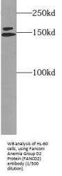 Fanconi Anemia Complementation Group D2 (FANCD2) Antibody