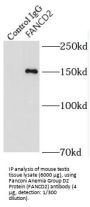 Fanconi Anemia Complementation Group D2 (FANCD2) Antibody