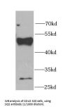 Farnesyl Diphosphate Farnesyltransferase 1 (FDFT1) Antibody