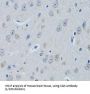 Farnesyl Diphosphate Farnesyltransferase 1 (FDFT1) Antibody