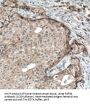 Fibroblast Growth Factor Receptor 4 (FGFR4) Antibody