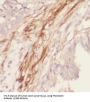 Fibronectin (FN1) Antibody