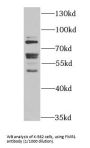 Fragile X Mental Retardation 1 (FMR1) Antibody