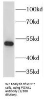 Forkhead Box Protein A1 (FOXA1) Antibody