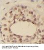 Forkhead Box Protein A1 (FOXA1) Antibody